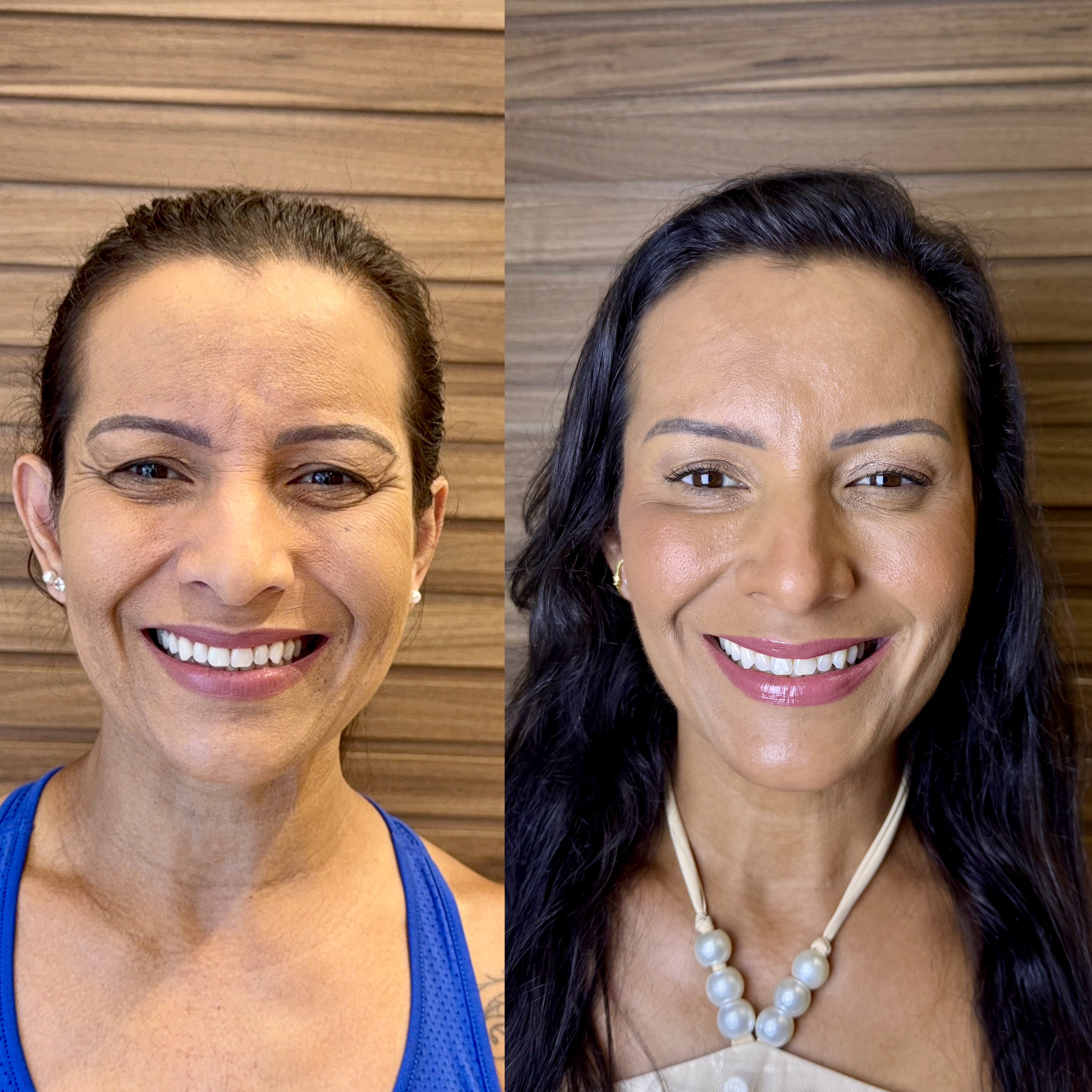 Antes e depois — rejuvenescimento facial