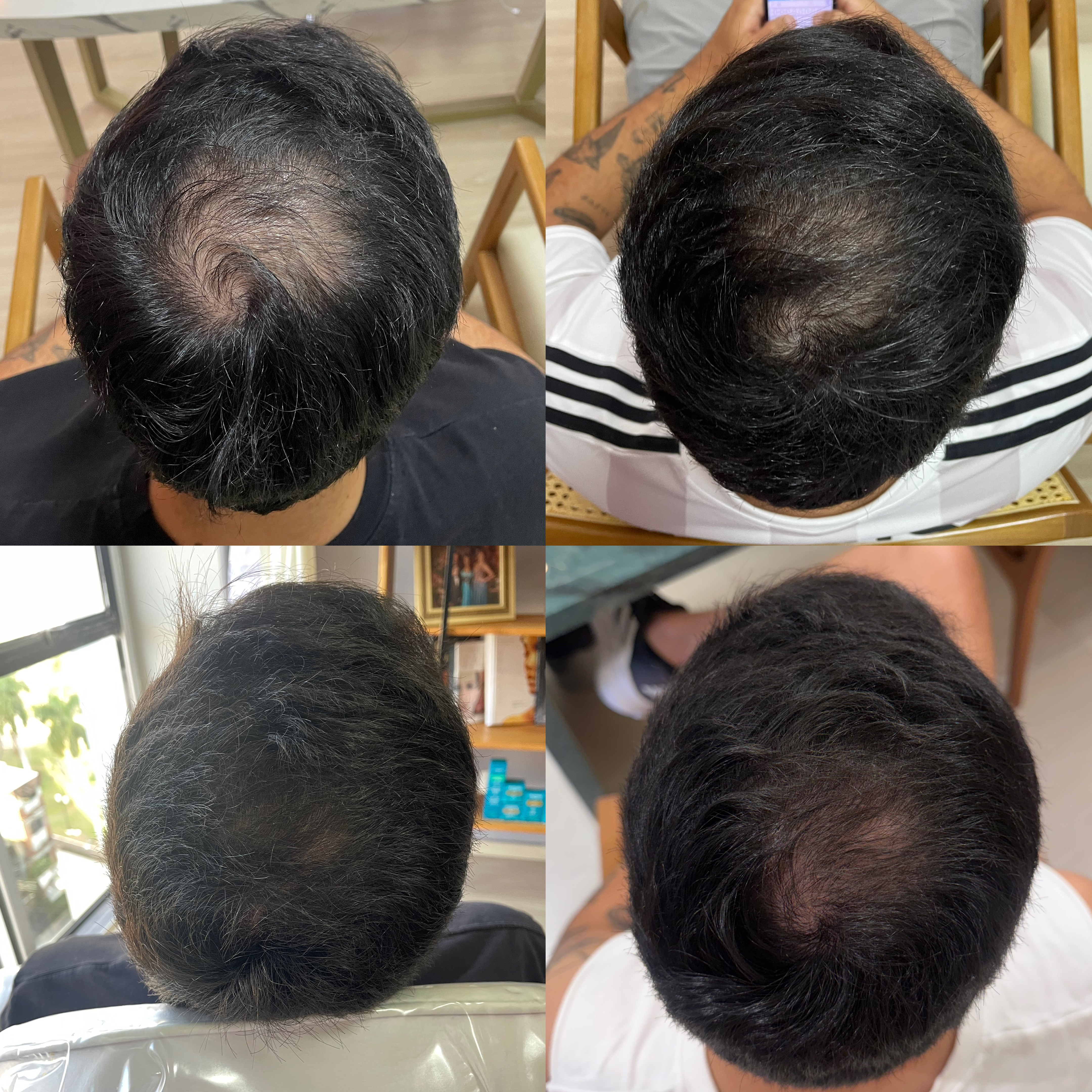 Antes e depois — tratamento capilar